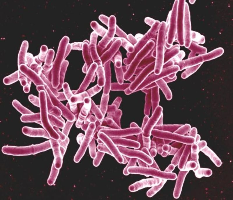 Tuberculosis Antibodies Rapid Test Cassette